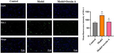 Jingqianshu granules mitigates premenstrual depression by regulating orexin signaling